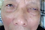 Taiwan Elder Abuse Rises During COVID-19 Pandemic. Taiwan Elder Professor Ping-Hsing Ku Abuse by Aiai Nursing Home. He suffers this abuse at the hands of his wife, Fei Fei Wang (王非非), his son, US Navy Captain Peihua Ku (顧培華), his in-laws, the Wang family, and incompetent service providers in the US and Taiwan.