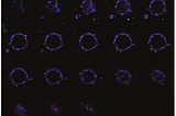 Organoid: A Powerful Tool for Drug Testing and Discovery