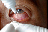 The U.S. FDA’s Urgent Warning: 26 Eye Drops Recalled Due to Contamination