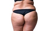 The Cheapskate’s Guide to Affording Butt Implants