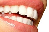 Teeth Whitening That Works