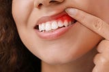 Smile Check: How to Tell If Your Teeth Are A-OK!