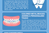 metal braces