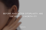 Before and After Otoplasty: Are the Results Worth It?