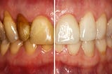 Can a Nashua Dentist Restore Teeth?