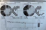 Charting My Blind Spots