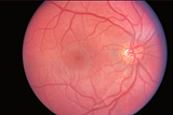 Image of a human retina.