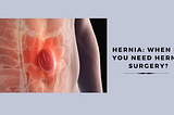 when-do-you-need-hernia-surgery