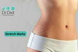 Stretch Marks Treatment in Bangalore