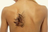 Benefits of Tattoo Removal