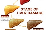 Stages of Liver Cancer Vector