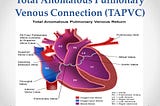 Know about “Total Anomalous Pulmonary Venous Connection (TAPVC)”