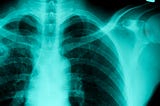 Tuberculosis — End in sight?