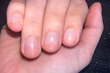 What I Learned When I Grew My Nails Out