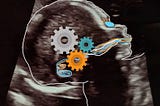 Ultrasound image of baby’s head with colored gears and lines in it