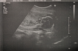 Vader to be: First trimester