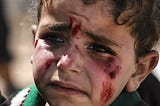 Image of a wounded Palestinian child crying.