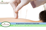 Acupuncture Treatment In Delhi NCR