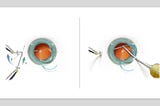 MST’s New Scleral IOL Fixation Solutions Kit Standardizes the Yamane Technique