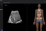 A new web-based ultrasound simulator to significantly improve students psychomotor skills requisite…