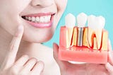 The Future Of Tooth Replacement: Painless Dental Implants