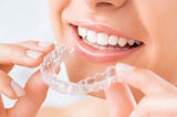 The Benefits of Invisible Braces