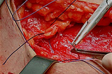 Síntese Cirúrgica: Entenda o que é e como fazer!