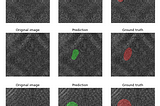 Quality Control of surface defects and inclusions using Deep Learning Image Segmentation
