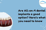 Are All-on-4 dental implants a good option? Here’s what you need to know