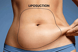 Tummy Liposuction Cost India