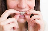 Achieve a Stunning Smile with Invisalign Near Toronto
