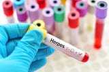 What exactly is Herpes disease? What is the disease’s level of danger? And what if you're pregnant.