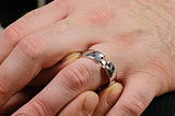 How to Wear Rings with Arthritic Fingers