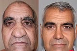 Iran’s Leading Cosmetic Surgeons: A Closer Look