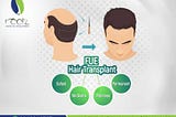 Fue hair transplant |Hair transplant before and after| Rootz