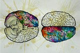 Metacognition