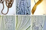 The Fascinating Plant Parasites —  Nematodes