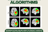 image of applications of segmentation algorithms. two rows of mri images labeled with regions of brain tumors. segmentation can be used to predict various cranial structures such as brain tumors from mri images.
