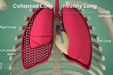 Detection and Semantic Segmentation of Pneumothorax Disease from X-Ray Images using Deep Learning