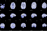 Identifying Resting-State Networks from fMRI Data Using ICAs