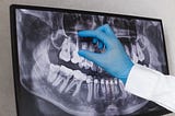 How often should you get dental x-rays?