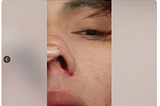 Italian-American actor, model and businessman Noah D’castellano was assaulted by a young man…