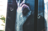 AI is about to save tens of millions of dollars (and hundreds of lives) with organ transplants.