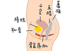 夾臀抬屁股不等於凱格爾運動