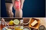 Home Remedies for Managing Arthritis Pain Naturally