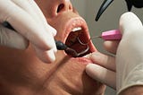 Dental ailments are on the increase that is why the necessity of permanently quality dental…
