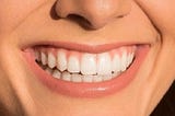 Dental Bonding vs. Veneers: Which Cosmetic Treatment is Right for You?