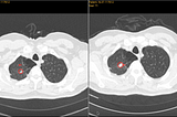 The Black Box Body: Cultural Context and Machine Learning in Medical Diagnostics