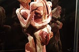 The Unhealthy Anatomy of Body Worlds