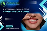 A better understanding of the causes of Black Gums